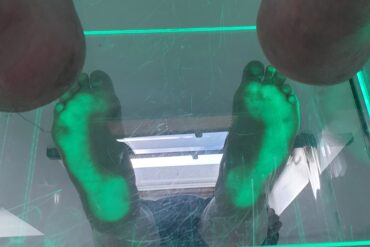 Komputerowe badanie stóp – kiedy warto je wykonać u dziecka