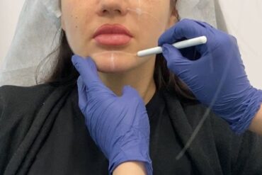 Jakie znaczenie dla mojego zdrowia mają zabiegi podologiczne?